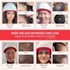 iRestore Professional Laser Red Light Therapy for Hair Growth System - FDA Cleared Hair Loss, Hair Thinning & Alopecia Treatment for Men & Women - Laser Cap for Hair Regrowth - 282 Lasers & LEDs by nugala - Image 3