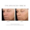 SkinMedica TNS Advanced+ Serum - Our Premium Facial Skin Care Product, the Secret to Flawless Skin. Age-Defying Face Serum for Women is Proven to Address Wrinkles and Fine Lines for Glowing Skin,1 Oz by nugala - Image 9