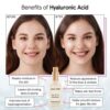 grace & stella Award Winning Hyaluronic Acid Serum (50ml/1.7 fl oz) Hyaluronic Acid Serum for Face - Acido Hialuronico Face Serum for Women - Hydrating Serum Remove Fine Lines, Wrinkles - Anti Aging by nugala - Image 4